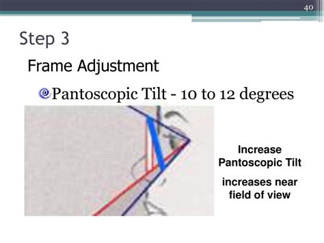 Prescribing Guidelines For Bifocals And Pals Ppt Download