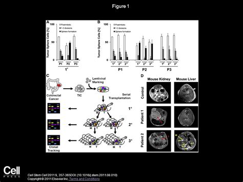 Distinct Types Of Tumor Initiating Cells Form Human Colon Cancer Tumors