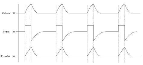 Curvas de volume fluxo e pressão na ventilação mecânica controlada