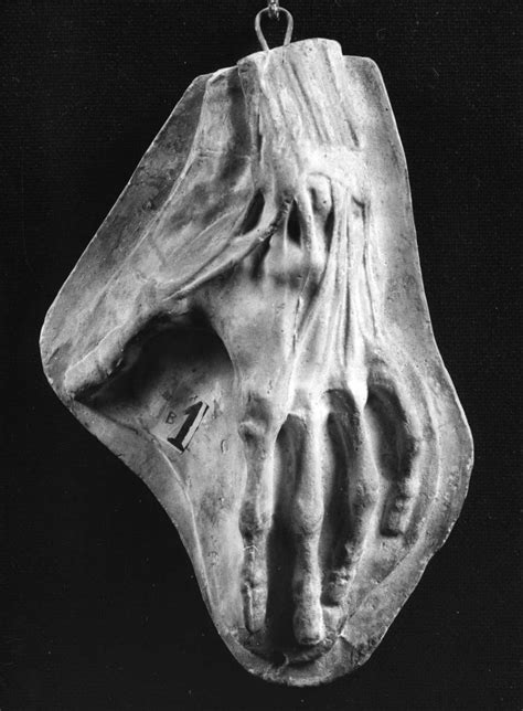 Mano Anatomica Scultura 1875 1899