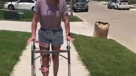 Hot Lady In A Leg Brace Pretty Lady Porn Videos