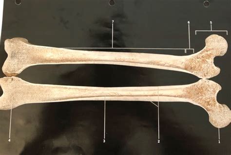 compact bone model flashcards quizlet