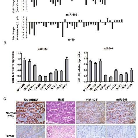 MiR 124 And MiR 506 Expression Levels Are Frequently Downregulated In