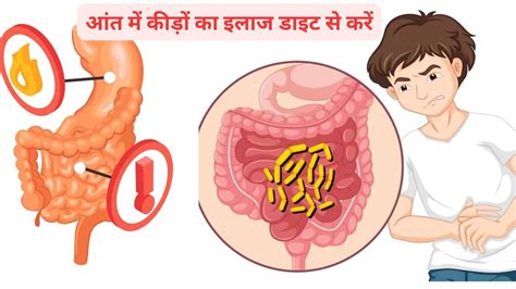 Intestinal Worms Signआंतों में कीड़े होने पर मर जाते हैं करोड़ों गुड