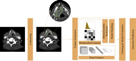 Dual Energy Computed Tomography In Head And Neck Imaging Neuroimaging