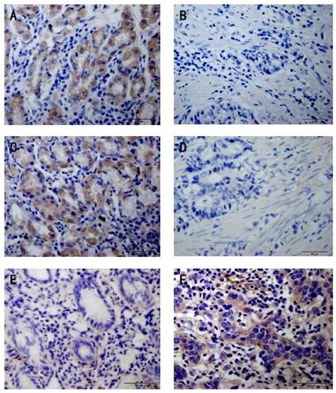 The Distinct Expression Patterns Of Claudin 2 6 And −11 Between