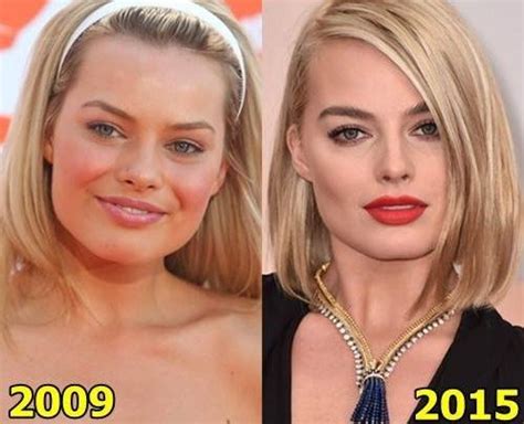 Margot Robbie Better look after plastic surgery? | Celebrity plastic ...