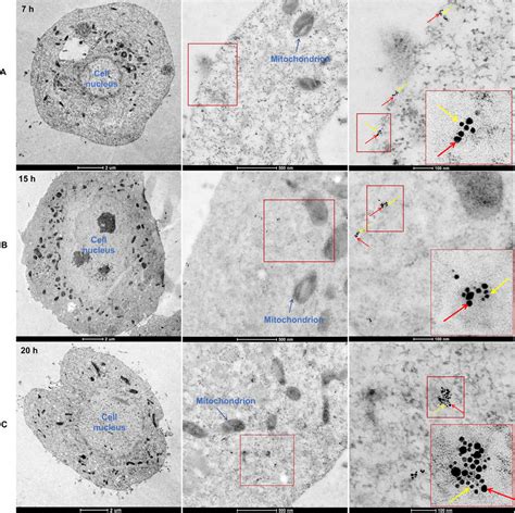 Immunoelectron Microscopy Showing Rsv Particle Entered Sf9 Cells A