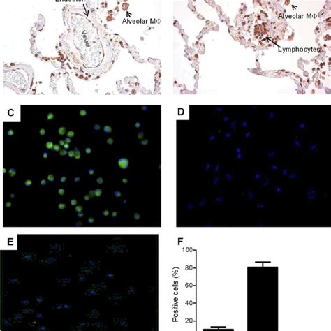 Expression Of Ccr In Human Copd Lung Tissue A And B Ccr Is