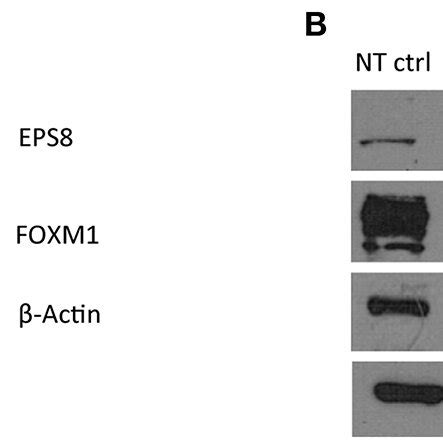 Eps Depletion By Rna Interference Suppresses Expression Of Foxm And