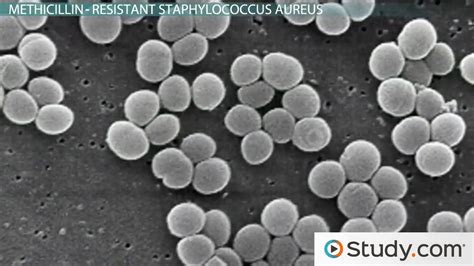 What Is A Staph Infection Causes Symptoms And Treatments Video