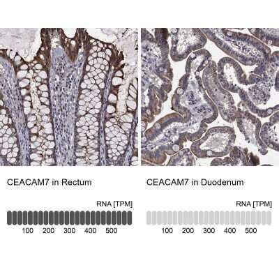 CEACAM7 Antibody NBP3 17026 Novus Biologicals