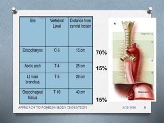 Approach to foreign body ingestion | PPT