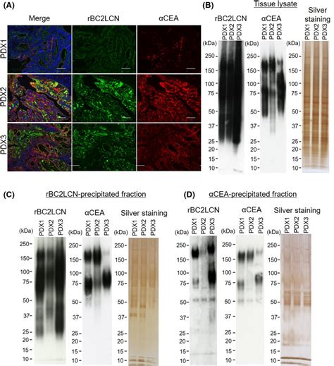 Carcinoembryonic Antigen Cea Is A Glycoprotein Ligand Of Rbc Lcn In