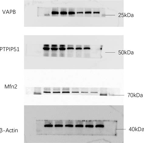 Figure From Mitochondriaassociated Endoplasmic Reticulum Membranes