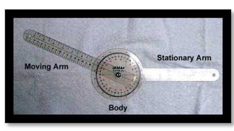 Goniometry Upper Limb Ppt Pptx