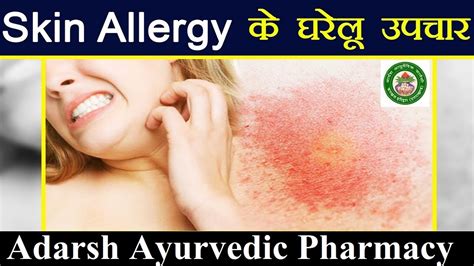 स्किन एलर्जी को आयुर्वेदिक उपचार से करें दूर Ayurveda Treatment For