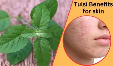 Tulsi benefits for skin