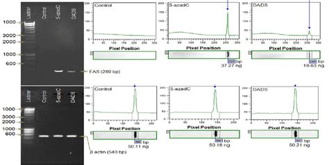 Agarose Gel Electrophoresis Of Pcr Product And Gel Analysis Using