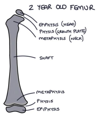 Pedi MSK Flashcards Quizlet