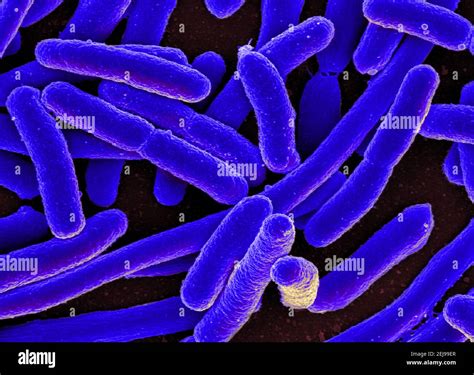 E.coli bacteria hi-res stock photography and images - Alamy