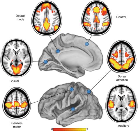 Resting State FMRI Radiology Key