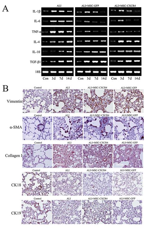 Activated Wnt Signaling Induces Myofibroblast Differentiation Of