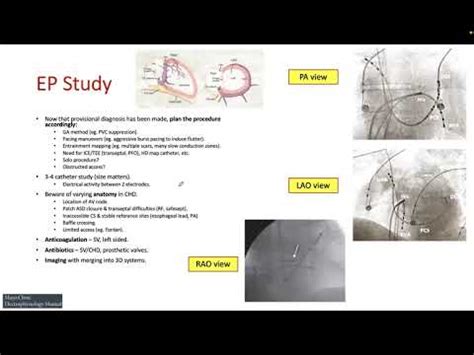 Basic EP Study YouTube