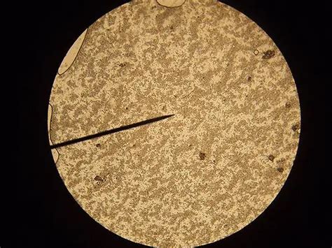 Yeast Cells Under Microscope 40x