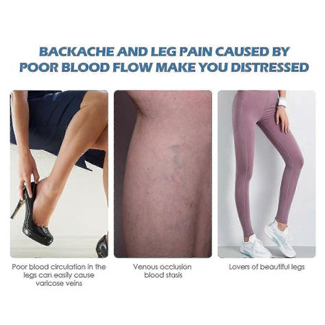 Vein Massage Spray Relief Earthworm Leg Massage Varicose Veins Repair
