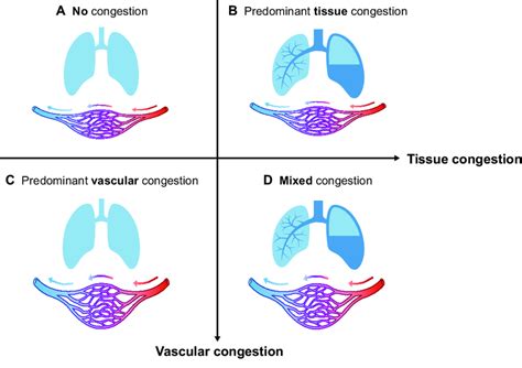 compartmental phenotypes  congestion  pocus   congestion