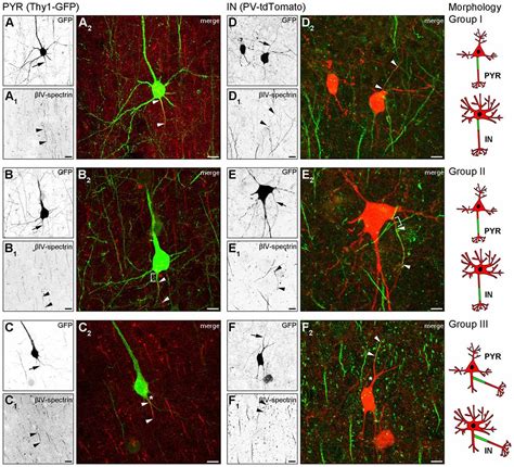 Frontiers Heterogeneity Of The Axon Initial Segment In Interneurons