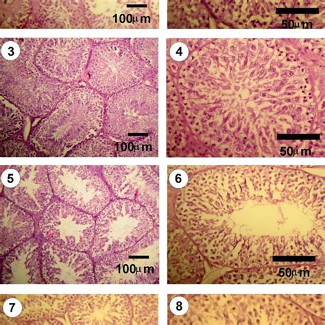 Photomicrograph Showing Leydig Cells In The Testes Section In G 2