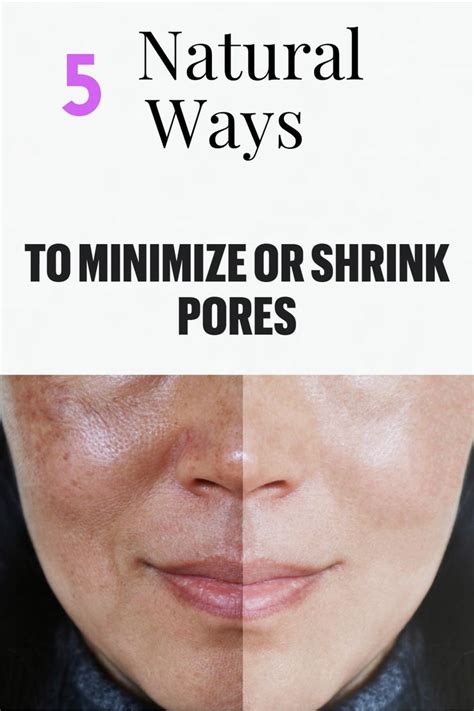 5 Natural Ways To Minimize Or Shrink Pores Womens Alphabet Shrink