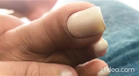 Whit Nails Hand Fetish Homemade Porn XHamster