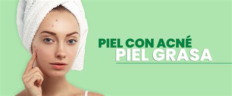 PIEL CON ACNÉ / PIEL GRASA - Piel y Salud - Laboratorios Bagó