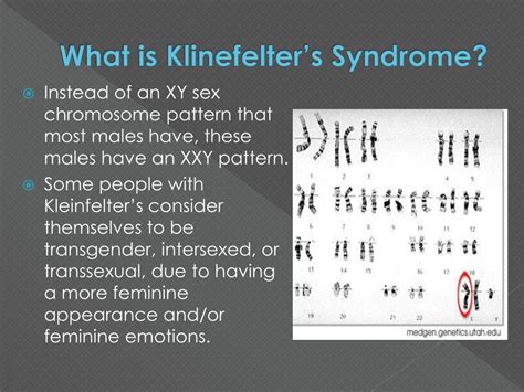 Ppt Klinefelter’s Syndrome Powerpoint Presentation Free Download Id 963511