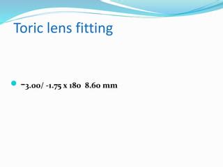 Soft Toric Contact Lens PPT