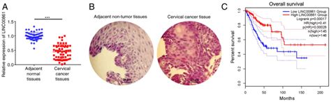 Linc Inhibits The Progression Of Cervical Cancer Cells By