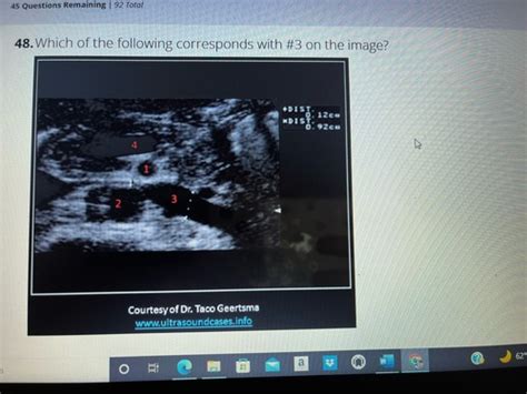 Ultrasound Registry Review Flashcards Quizlet