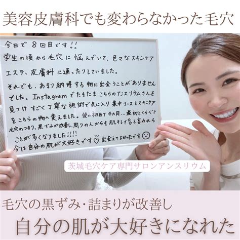 【お客様の声】美容皮膚科でも変わらなかった毛穴 茨城毛穴専門サロンアンスリウム 水貝茉以 土浦つくば 水戸 毛穴の黒ずみ 毛穴の開き