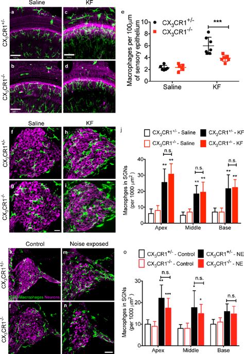 FIG URE 3 Macrophage Density In The Damaged Cochleae Of CX 3 CR1