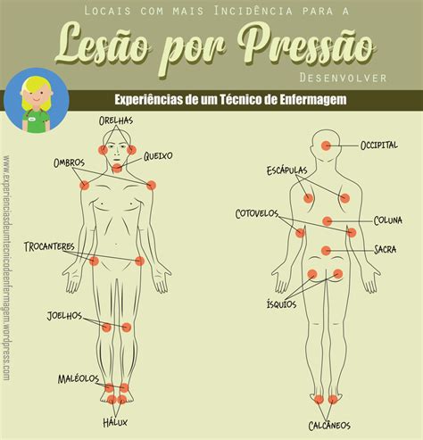 Locais Comuns Para Aparecimento De Lesões De Pressão Enfermagem Ilustrada Material De