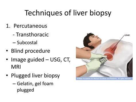 Scheuer S Liver Biopsy Interpretation 7