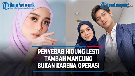 Penyebab Hidung Lesti Kejora Tambah Mancung Bukan Karena Operasi