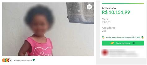 Menina que teve perna amputada após atropelamento apresenta melhora na