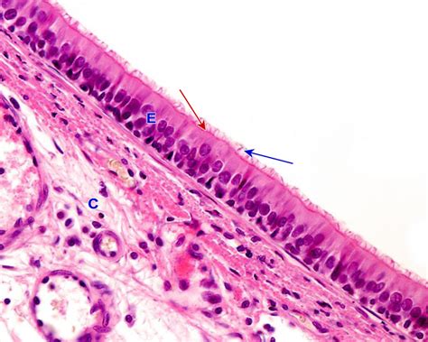 Histologia Del Tejido Epitelial Resumen Epitelios De Revestimiento