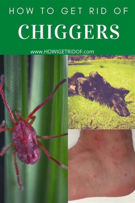 How To Get Rid Of Chiggers How I Get Rid Of