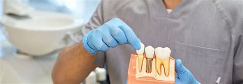 Implantes Dentales vs Prótesis Tradicionales