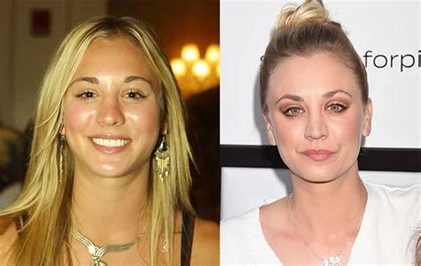 Kaley Cuoco Before And After